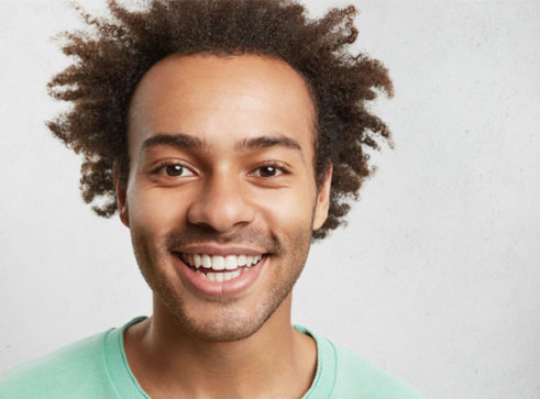 White Dental Fillings Oadby, Leicester - Treatment - Smile Perfections Dental