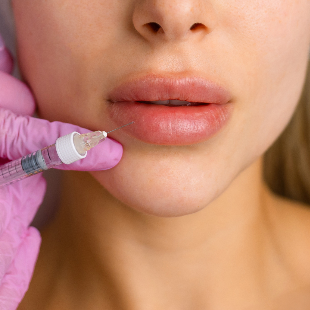 Safe & Subtle Botox Leicester | Look Refreshed Instantly