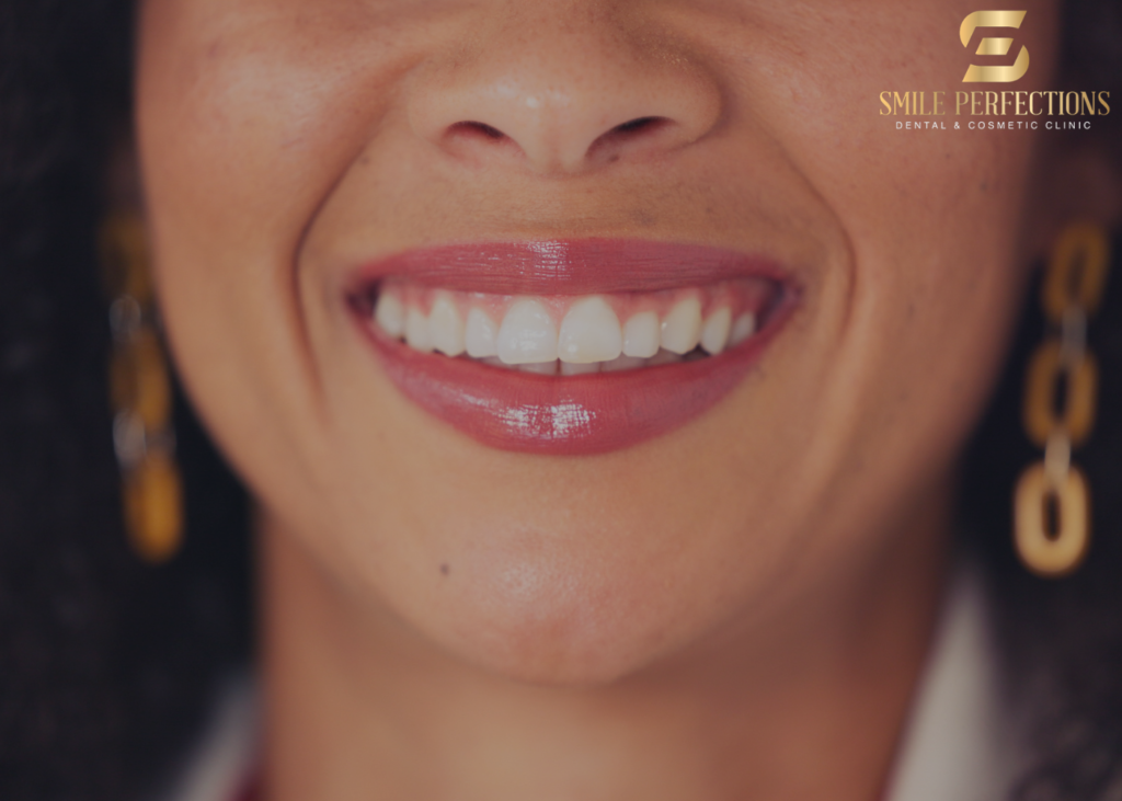 bond on tooth - what is tooth bonding